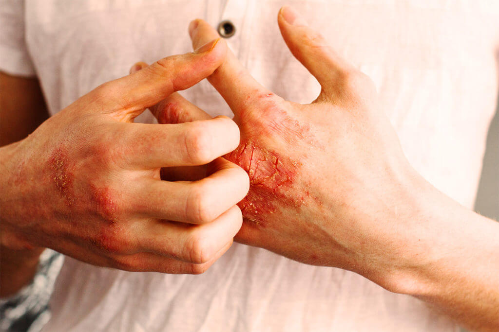 Traitement alternatif sans médicaments