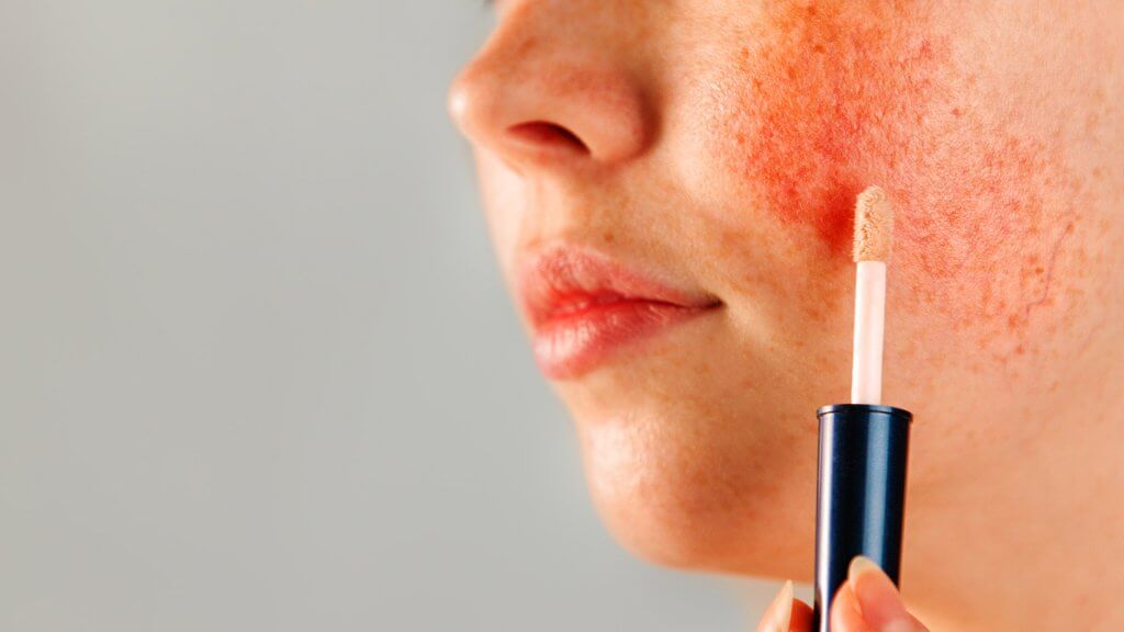 Rötungen mit dem Concealer korrigieren