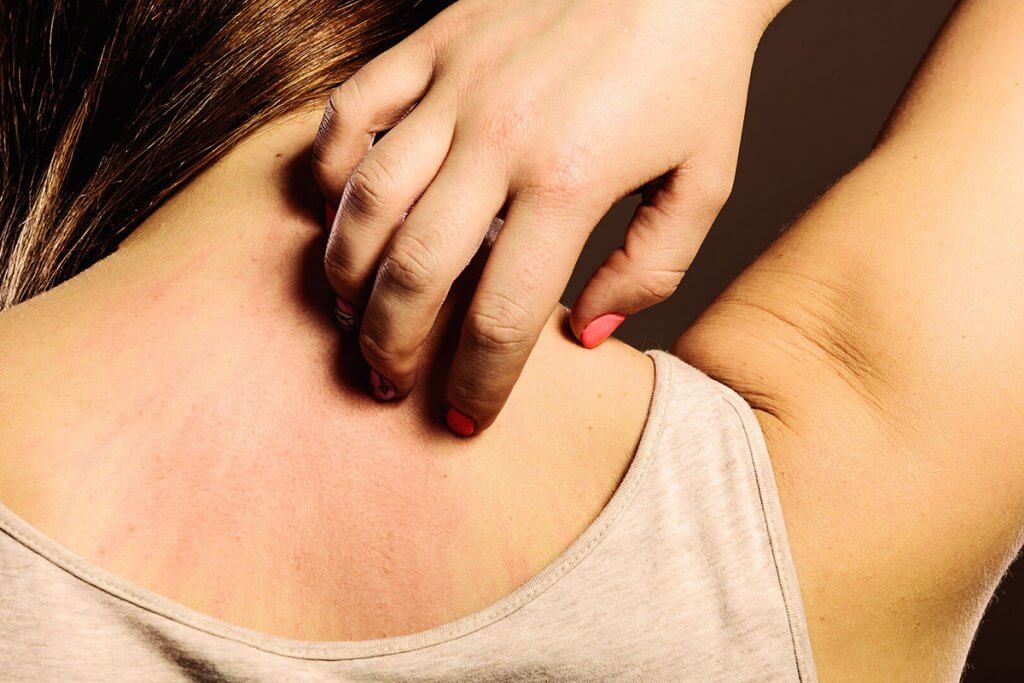 Help with severe itching all over the body