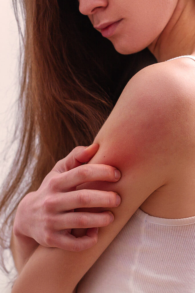 Itching all over the body - Possible causes of itchy skin