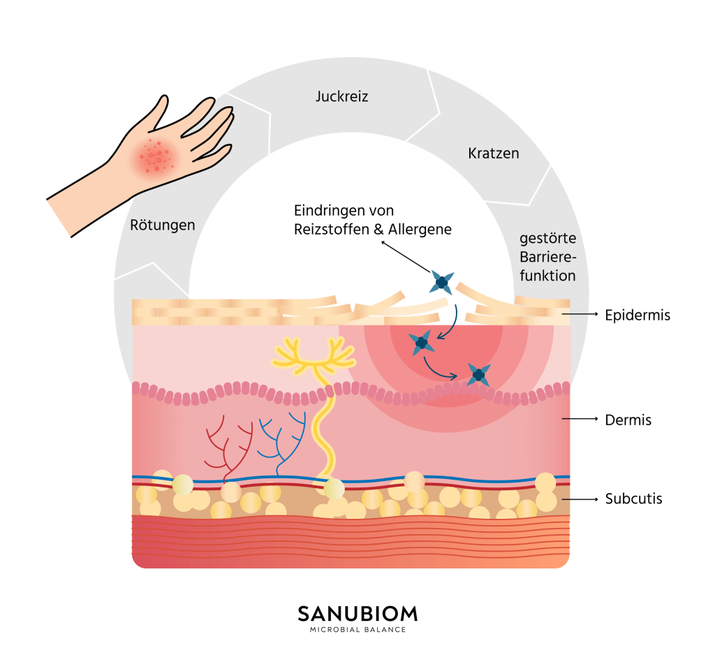 Comment naissent les démangeaisons