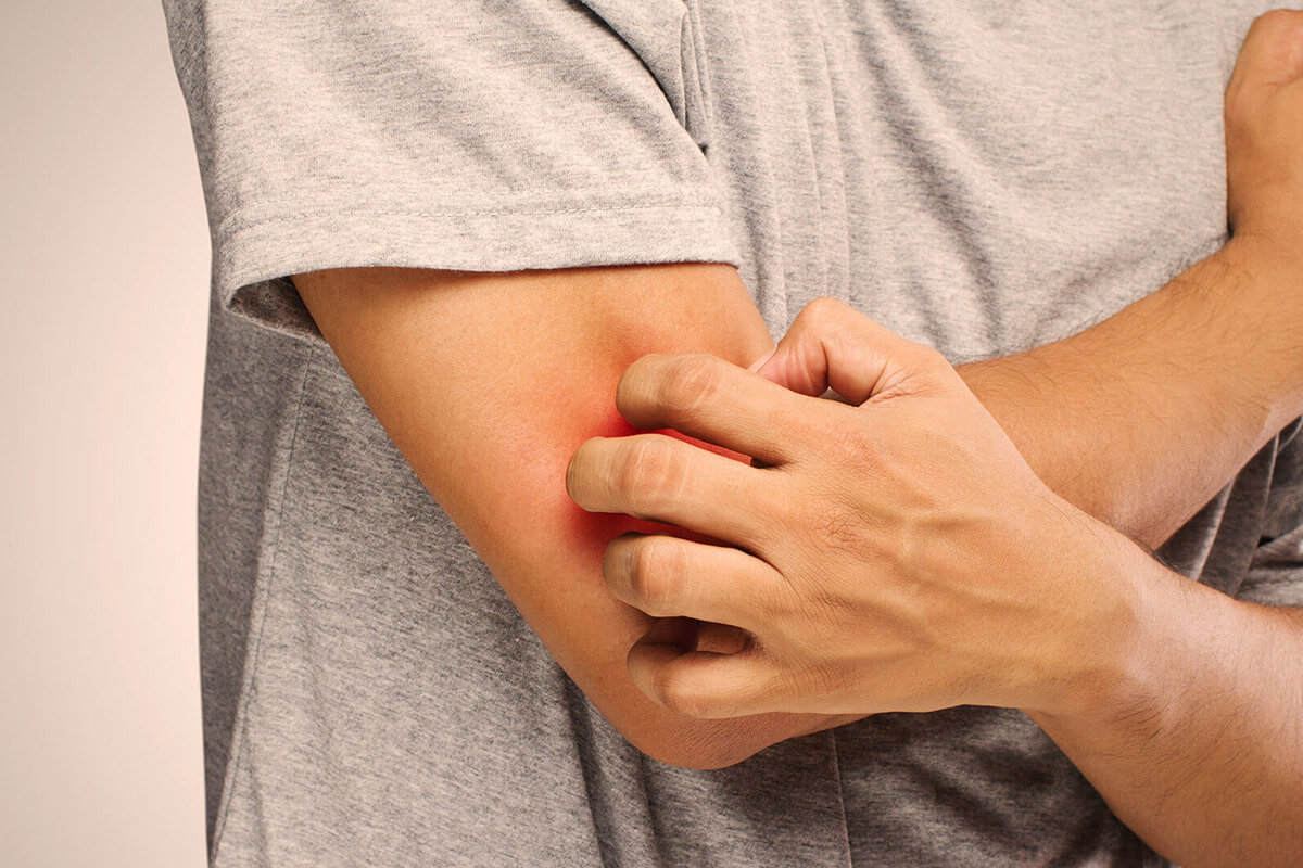 Symptômes en cas de démangeaisons sur tout le corps